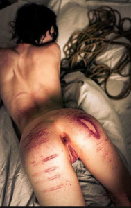 Лопнула кожа.jpg