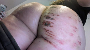 Обработали правую булочку.jpg