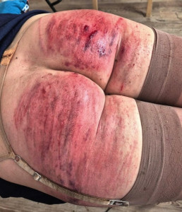 Well-whipped butt.jpg